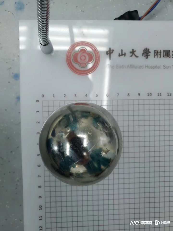 副本中年大叔直肠卡钢球，医生妙计巧取出20220613(1)(1)259.png
