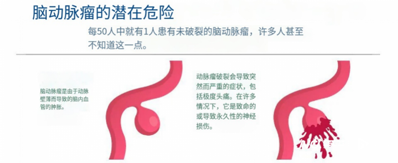 副本20230726 中年女子熬夜刷短视频致脑出血360.png