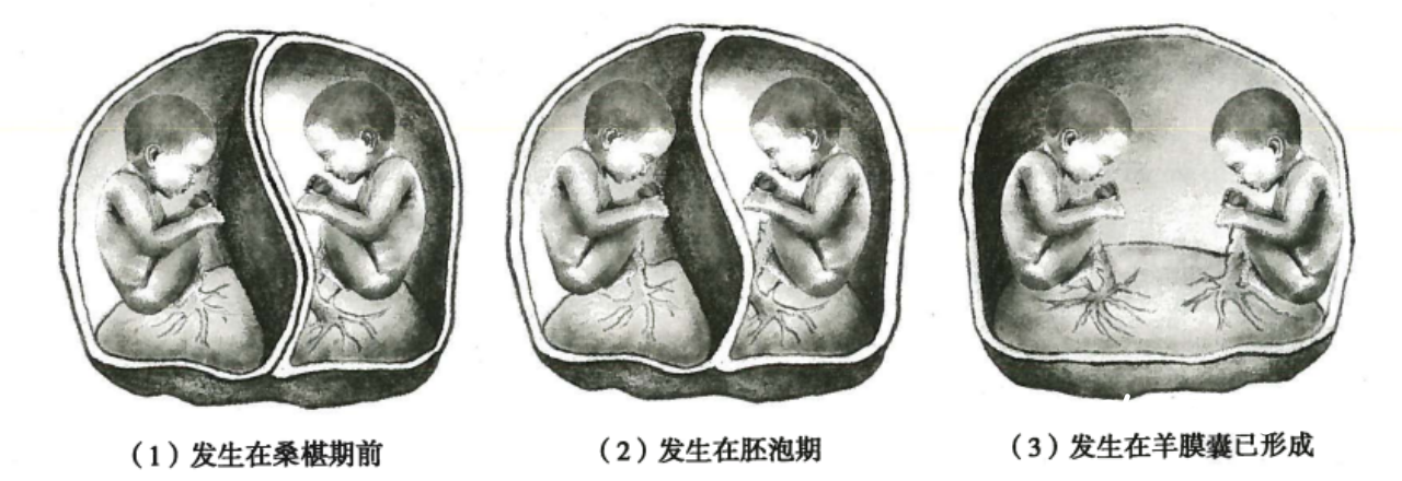 副本惊险！双胎脐带打结似麻花，“胎儿镜”为产妇排忧解难20220523584.png