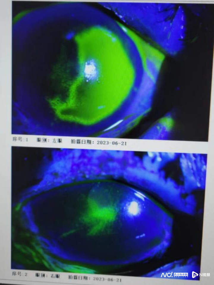 副本20230706 染发后 她泪流满面地走进眼科诊室277.png